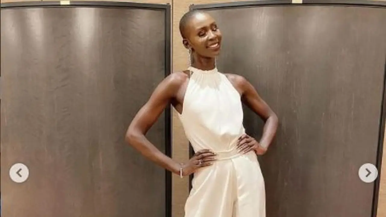 Miss Universe Kanada Tanggapi Ejekan Ayam Gosong dari Warganet