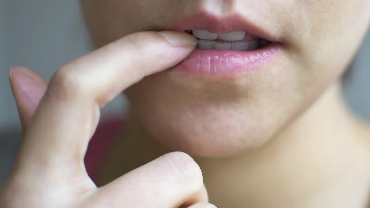 Dua Kista yang Sering Terjadi Jika Anak Senang Gigit Bibir