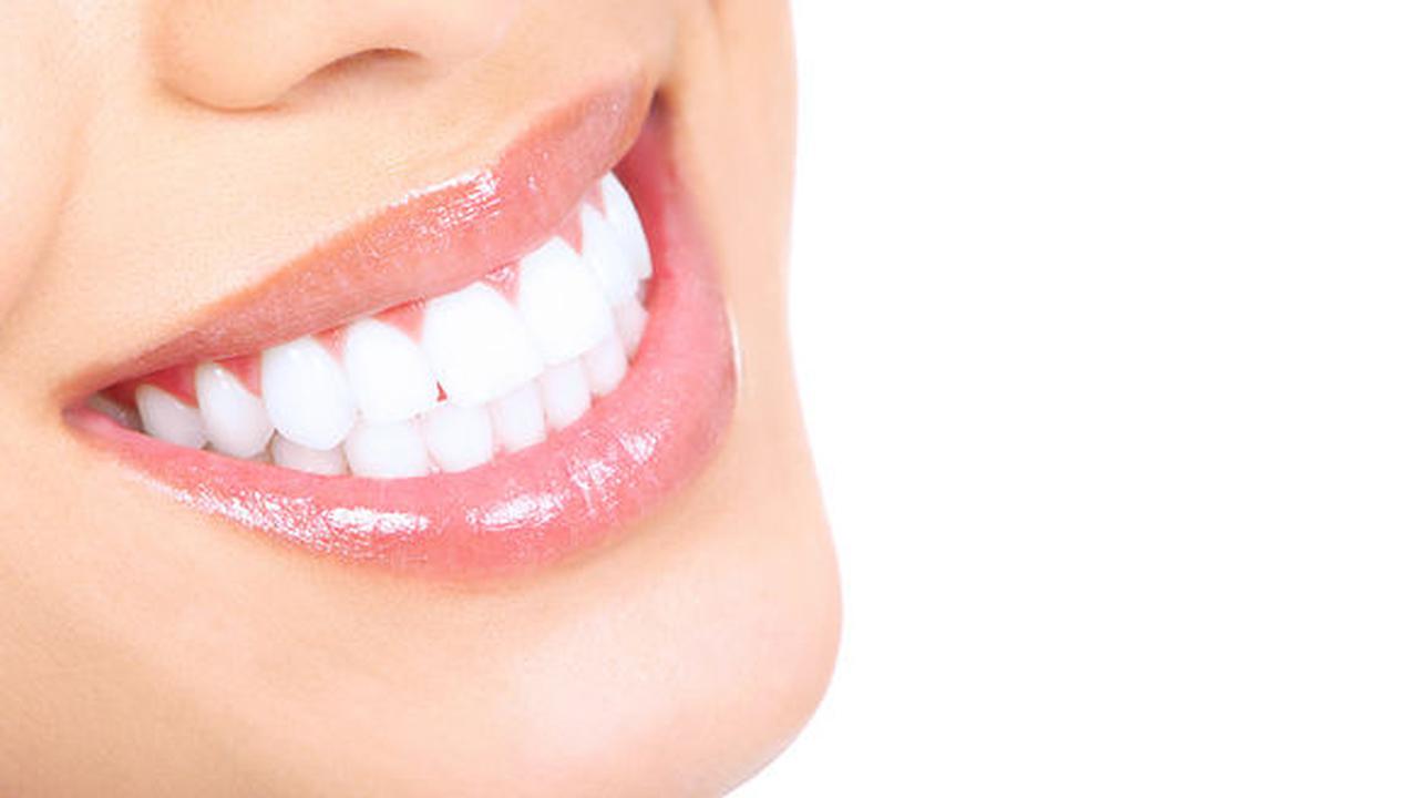 Cara Memutihkan Gigi