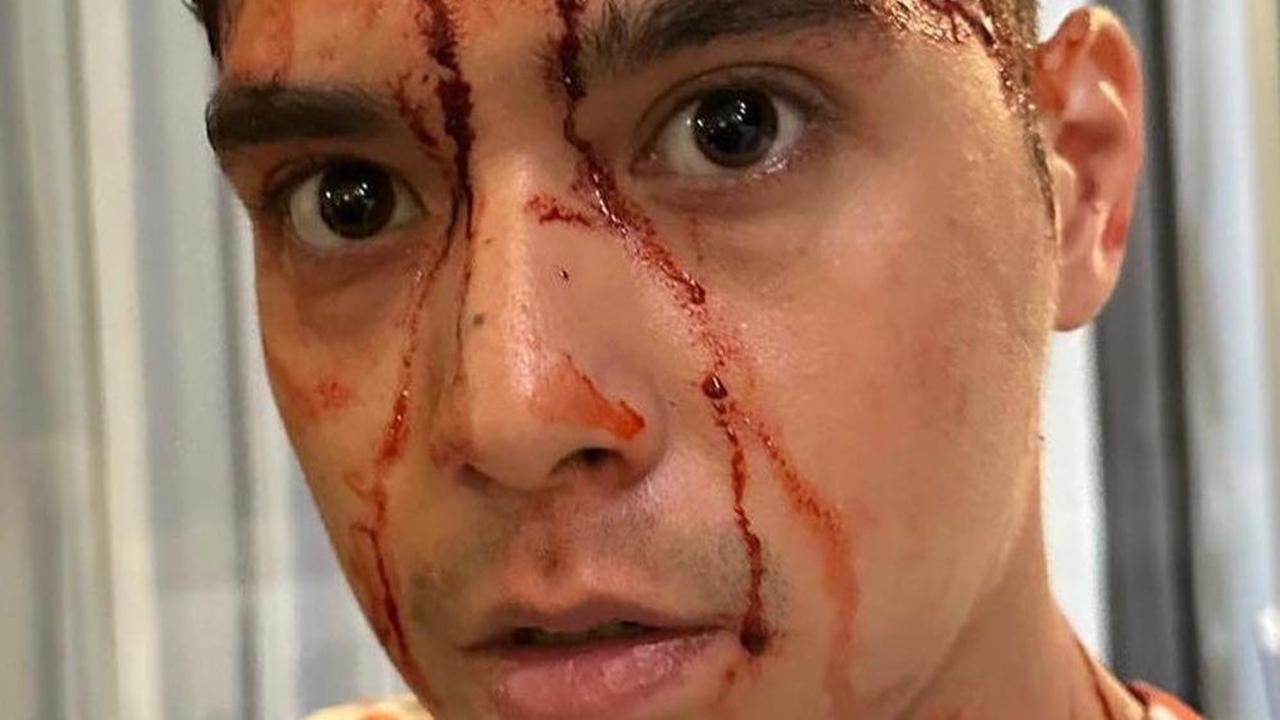 Al Ghazali Tiba-tiba Unggah Foto Bercucuran 'Darah', Kenapa?