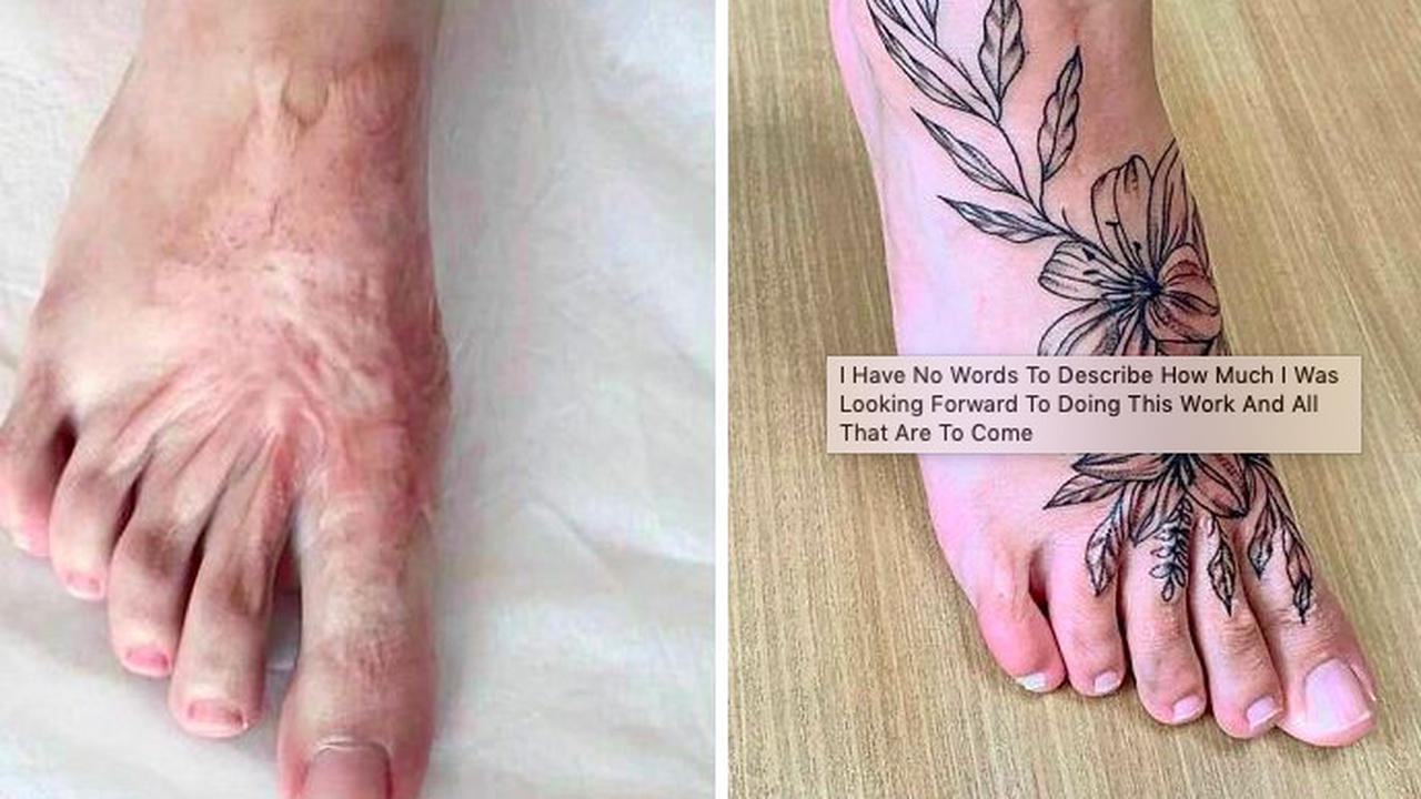 tutupi bekas luka dengan tato