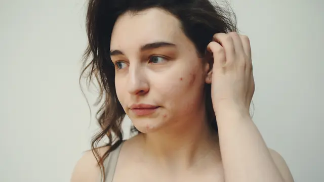 Teh sebagai perawatan wajah