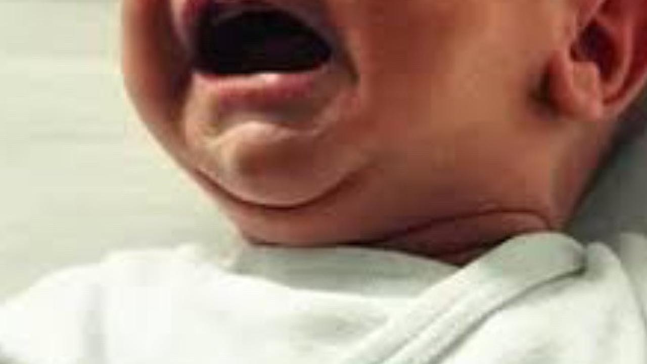 Viral Bayi Umur 13 Bulan Dikerok Babysitter, Ibunda Langsung Syok Lihat Kulit Anaknya