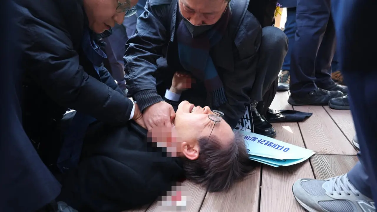 Pemimpin partai oposisi Korea Selatan Lee Jae-myung dirawat setelah ditikam di Busan pada Selasa 2 Januari 2024. (YONHAP/AFP)