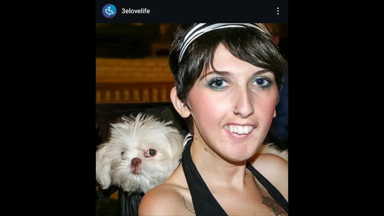 Annie Hopkins, Sosok Penyandang Disabilitas di Hari Penerimaan Internasional