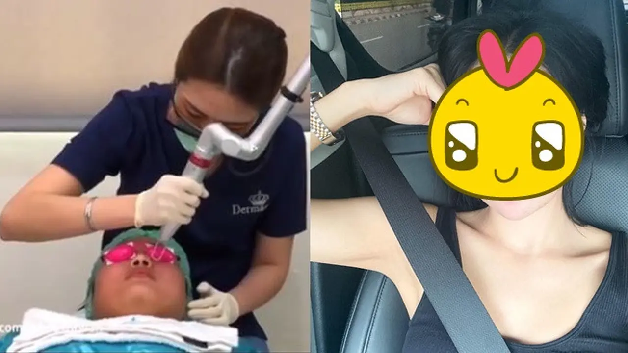 Perawatan Hollywood Peel, Ini 6 Potret Terbaru Wika Salim Makin Glowing