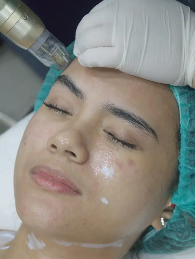 Jelang Usia 30an, Audi Marissa Tampil Makin Glowing dengan Perawatan Kecantikan ala Selebriti Korea