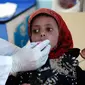  Seorang anak yang diduga terinfeksi kolera menerima perawatan di sebuah rumah sakit di Sanaa, Yaman (15/5). Pihak berwenang mengumumkan keadaan darurat dan ratusan orang dinyatakan meninggal akibat wabah penyakit ini. (AFP Photo/Mohammed Huwais)