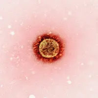 Ilustrasi Cacar Air (Foto: Unsplash/National Institute of Allergy and Infectious Diseases)