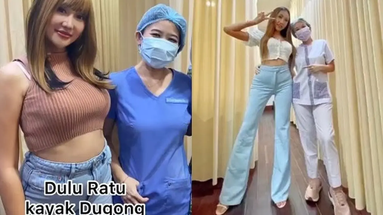 Lucinta Luna Turun Berat Badan 11 Kg, Ini 6 Potret Transformasinya