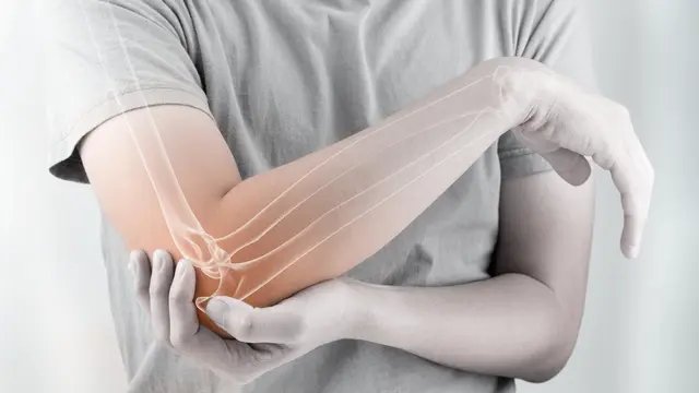 Penyebab osteoporosis