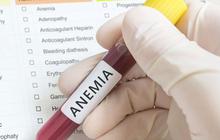 Kenali Apa Itu Anemia Aplastik, Faktor Risiko, Serta Gejalanya