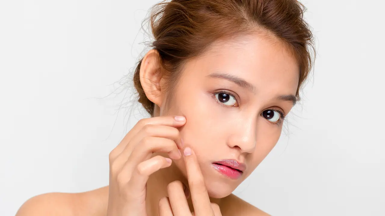 Beauty Tips: Acne Spot Treatment