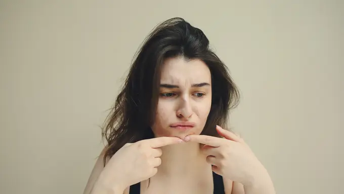 4 Cara Mengatasi Jerawat pada Kulit Sensitif, Hindari Pakai Banyak Produk Skincare