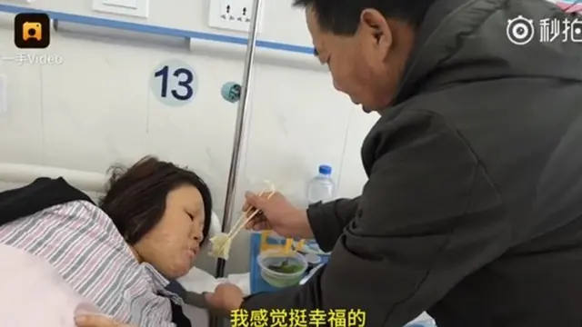 [Bintang] Diceraikan Suami Usai Wajah Terbakar, Kisah Wanita Ini Jadi Viral