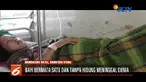 Sembilan jam usai dilahirkan, bayi perempuan yang lahir dengan kondisi memiliki satu mata di Mandailing Natal, Sumatra Utara, akhirnya meninggal dunia.