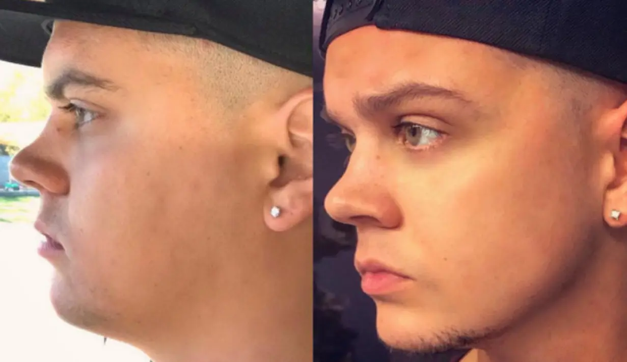 Tyler Baltierra kehilangan 15kg bobot tubuhnya dalam dua bulan. Ia mengatakan bahwa tak berusaha untuk diet. (instagram/tylerbaltierra)