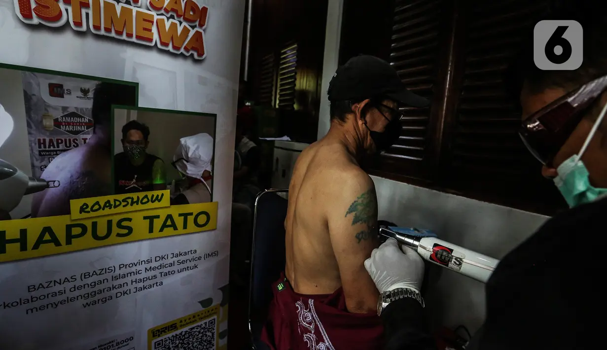Peserta mengikuti kegiatan hapus tato gratis di Dewan Pimpinan Pusat Forum Ulama Habaib Jakarta, Selasa (19/4/2022). Kegiatan ini diperuntukan bagi masyarakat yang hendak "berhijrah" namun terkendala biaya dalam penghapusan tato, berlangsung dari tanggal 18-19 April 2022. (Liputan6.com/Johan Tallo)