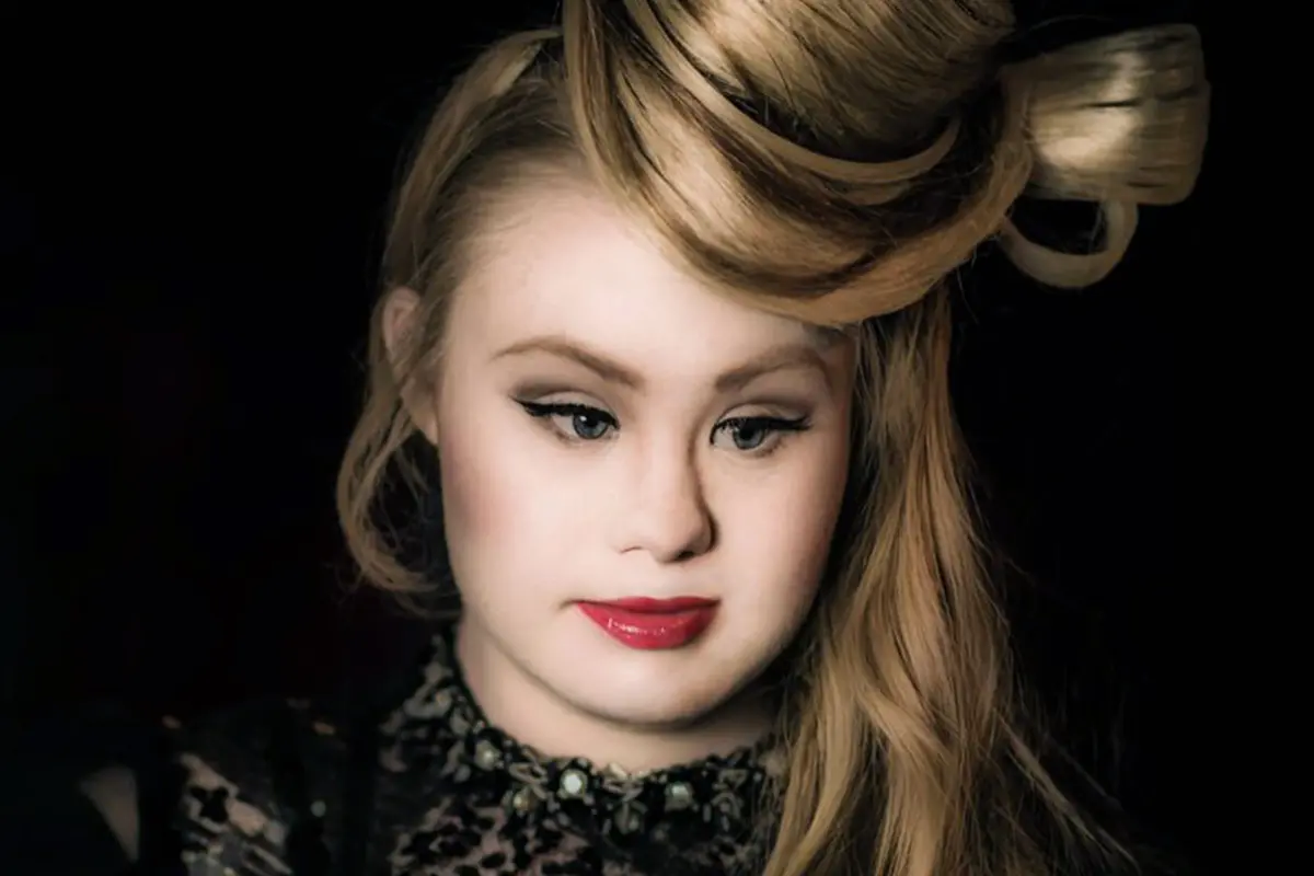 Keren! Anak Penderita Kanker dan Down Syndrome Sukses Jadi Model