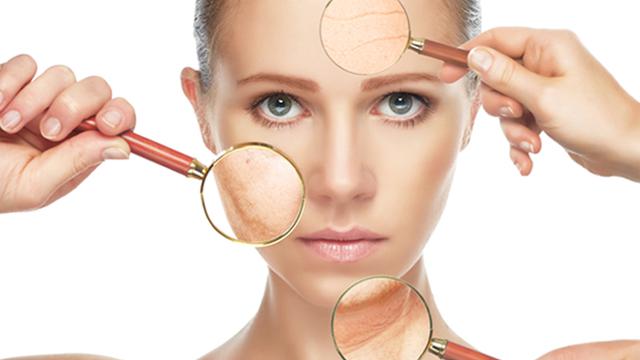Wanita Paling Benci Dengan 4 Masalah Kulit Ini Health Liputan6 Com