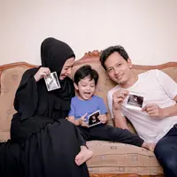 Fedii Nuril dan Calysta Vanny (Instagram/fedinuril)