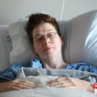 Ilustrasi sakit lupus. Sumber foto: unsplash.com.