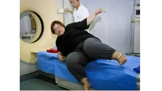 Youtuber Ini Meninggal saat Siaran Langsung Mukbang, Berat Badan Capai 300 Kg