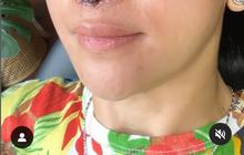 Santai Meski Tuai Cibiran, Potret Farida Nurhan Kembali Oplas Hidung Demi Penampilan Maksimal