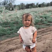 Achondroplasia merupakan salah satu bentuk displasia tulang karena adanya kelainan genetik. (Foto: Instagram/charlikateadams)