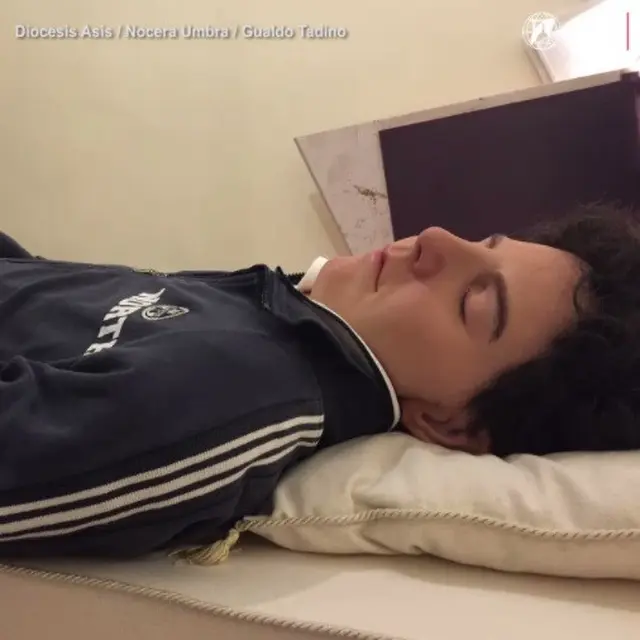 Jenazah, Venerabilis Carlo Acutis, Leukemia, Kanker Darah