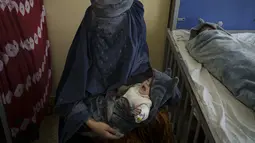 Seorang perempuan menggendong salah satu dari dua bayinya di bangsal gizi buruk Rumah Sakit Anak Indira Gandhi di Kabul, Selasa (5/10/2021). UNICEF menyebut hampir dua juta anak-anak Afghanistan berisiko kekurangan gizi karena kemiskinan akut di tengah lonjakan harga bahan makanan. (AP/Felipe Dana)