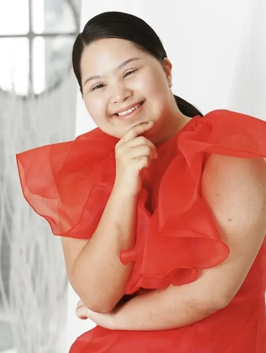 Namira Zania Siregar menjadi panutan masa kini. Di usia muda dengan keterbatasan yang dimilikinya, ia bisa sukses menjadi seorang model yang menginspirasi. [Foto: Instagram/ Namira Zania]