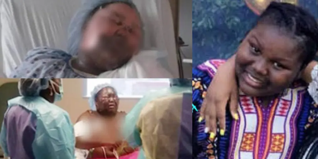 Jamoneisha Merritt, yang dilarikan ke rumah sakit akibat wajah, leher, dan dada terbakar akibat Hot Water Challenge | Sumber Foto: akpraise.com