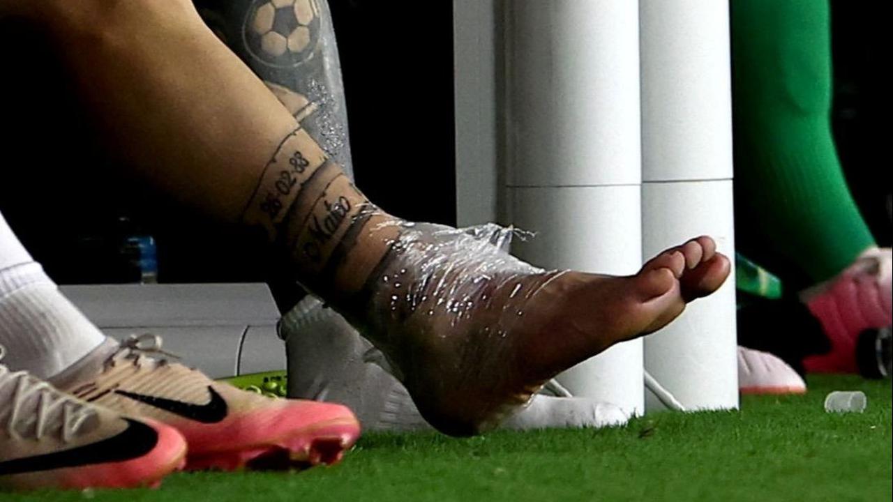 FOTO: Penampakan Bengkak Kaki Messi yang Keseleo hingga Membuat Menangis Tersedu-sedu di Final Copa America 2024