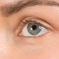 Kelainan pada kelopak akibat iritasi bisa menjadi ancaman yang cukup mengkhawatirkan. (Foto: Freepik/master1305)