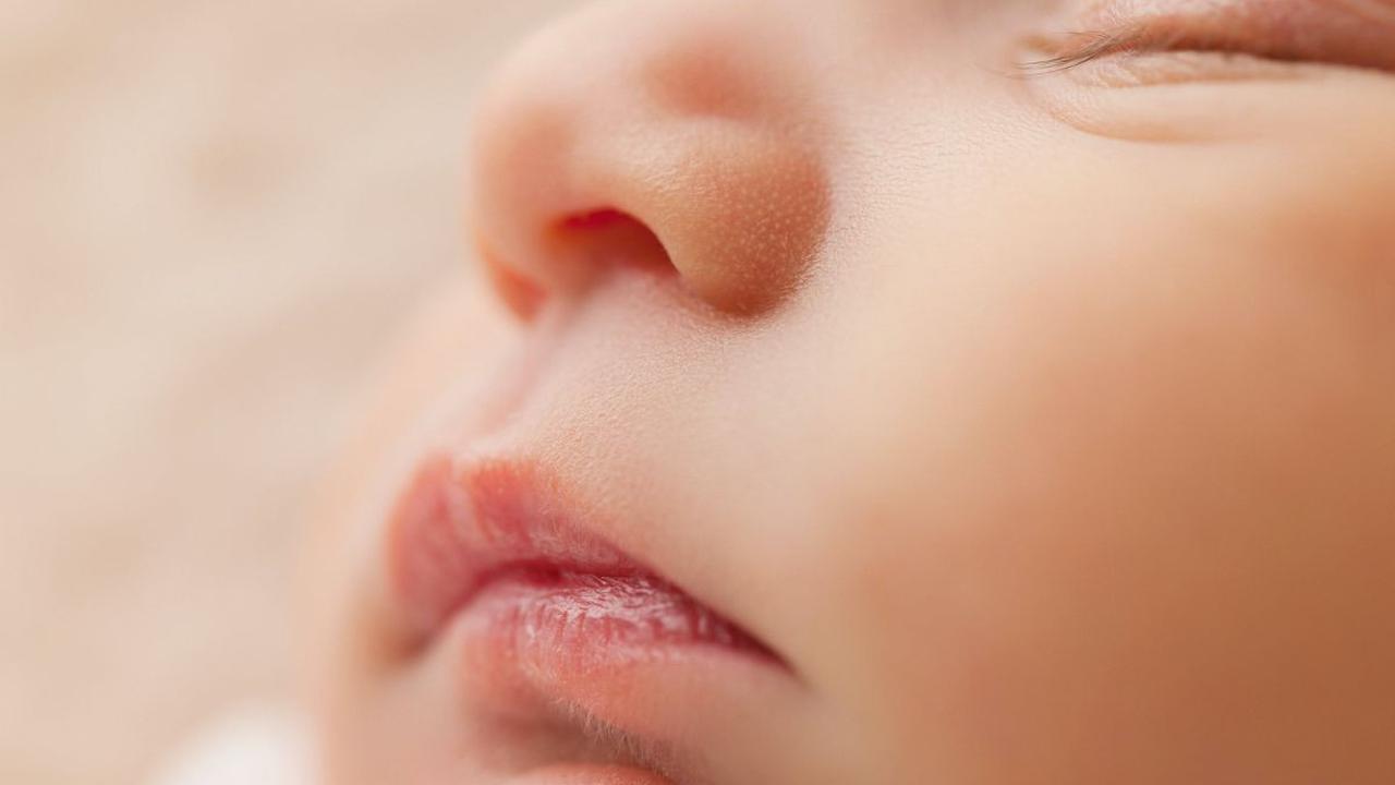 Cara Mengatasi Bibir Kering pada Anak