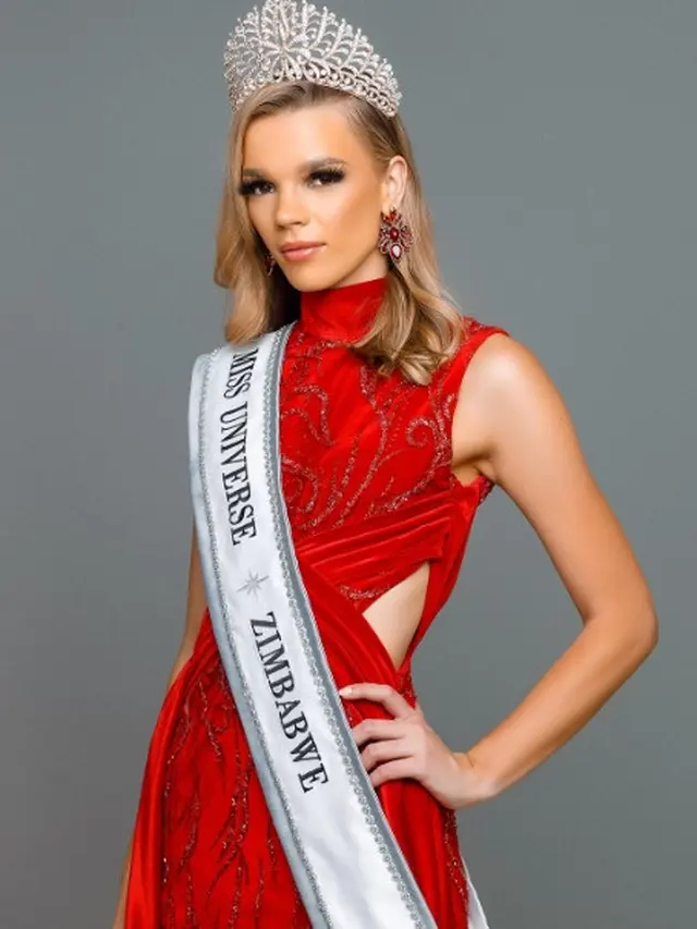 Kontroversi Rasial Mencuat Usai Mahkota Miss Universe Zimbabwe Diraih Perempuan Kulit Putih