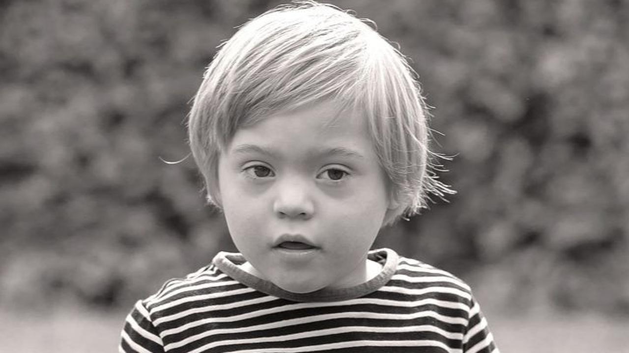 21 Maret Hari Down Syndrome Sedunia, Ketahui Sejarahnya