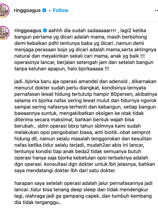 Bjorka Anak Ringgo Agus Rahman Operasi, Sering Henti Napas akibat ...