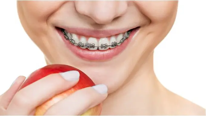 Copyright: thinkstockphotos.com