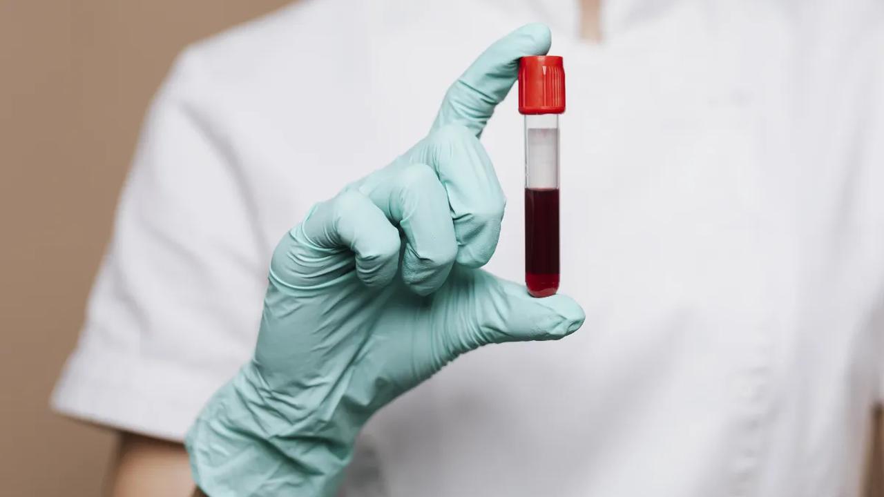 Apa Itu Virus Nipah?<br>