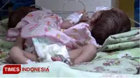 Bayi kembar di RSUD Tongas, Kabupaten Probolinggo (TIMES Indonesia/Happy)