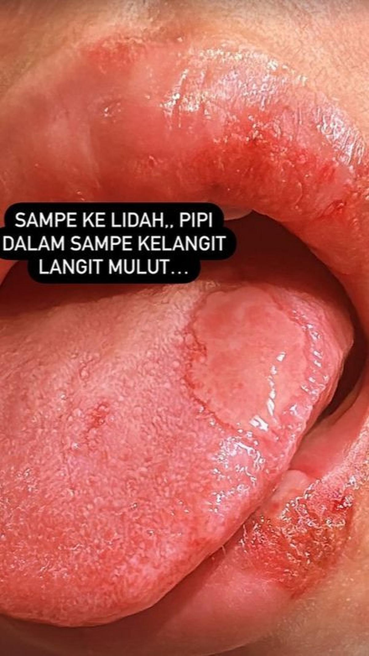 Dokter di Indonesia sendiri masih belum mampu mengidentifikasi jenis penyakit yang menyerang Kartika.