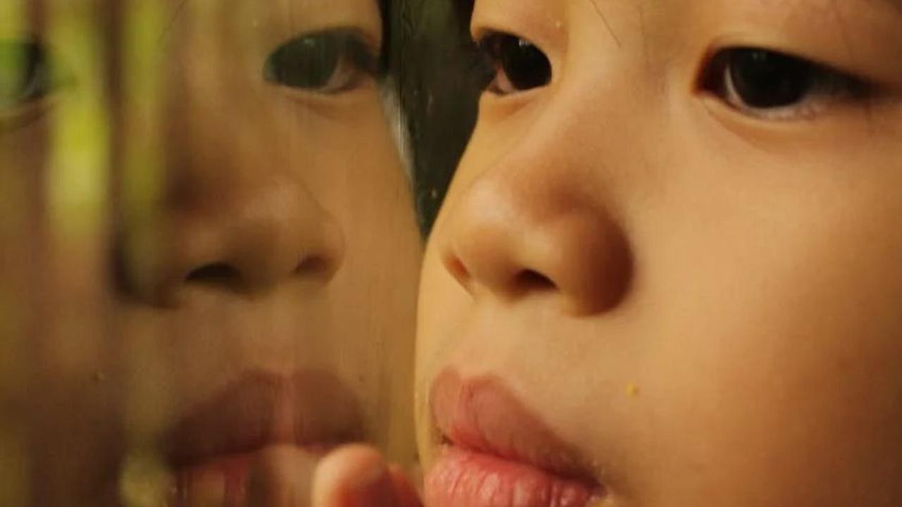 Tidak hanya itu, ada juga kasus langka di mana penyakit Kawasaki bisa menyebabkan bibir merah, kering, pecah-pecah, dan bahkan mengeluarkan darah. Penyakit ini umumnya menyerang anak-anak di bawah 14 tahun dan memerlukan perhatian medis.