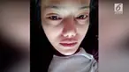 Wanita bernama Benyapa Supap mengalami iritasi pada kedua matanya setelah melakukan metode pemanjangan bulu mata. Diduga bahwa bulu mata palsu ditempel dengan lem super.