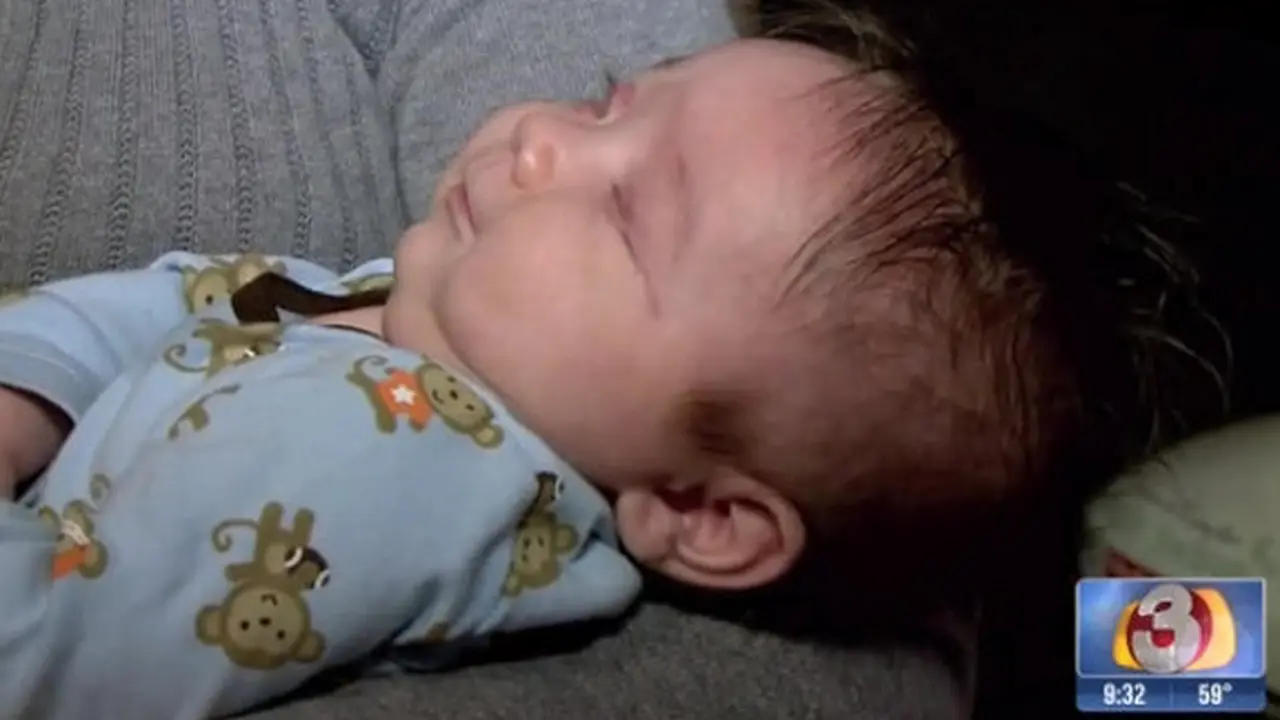 Bayi Ini Lahir Tanpa Bola Mata