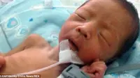 Bayi Ajaib, Masih Hidup Usai Dikubur