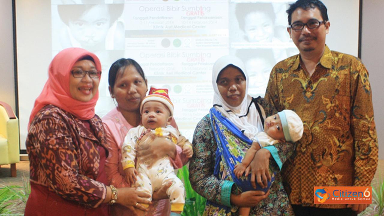 Mahasiswa UMY Berikan Senyuman pada Penderita Bibir Sumbing