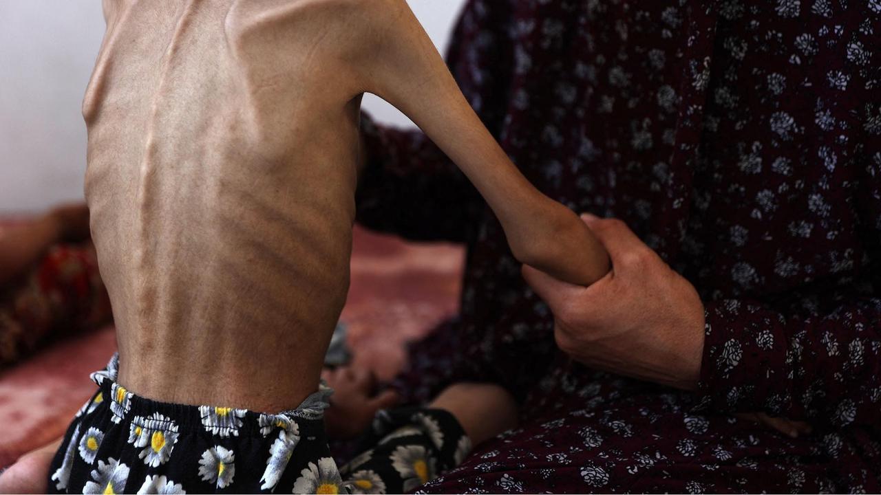 FOTO: Potret Pedih Mariam Anak 9 Tahun, Korban Kelaparan Gaza