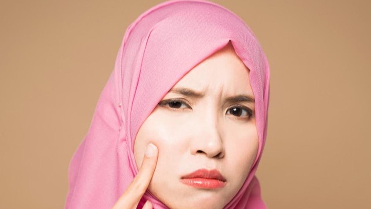Muncul Jerawat